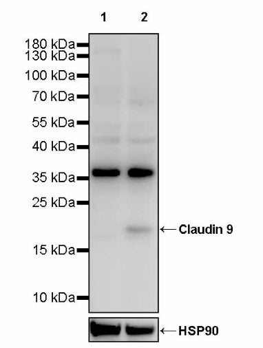 Claudin 9 Recombinant Rabbit mAb (S-2849-16)