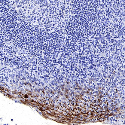 MUC1/EMA Mouse mAb (SDT-777-37)