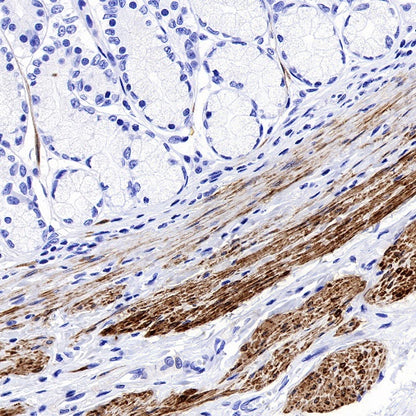 Calponin-1 Recombinant Rabbit mAb (S-R161)