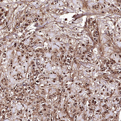 DNA Ligase IV/LIG4 Recombinant Rabbit mAb (S-2237-118)