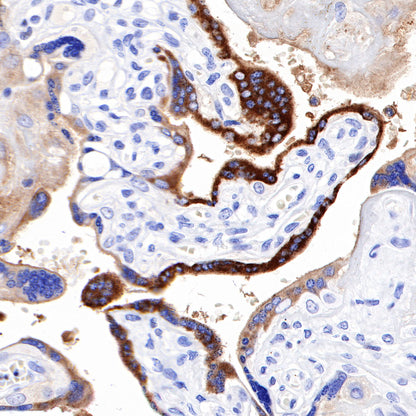 PAPP-A Recombinant Rabbit mAb (SDT-226-46)