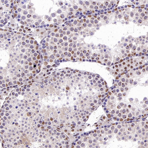 KDM4A Recombinant Rabbit mAb (S-957-138)