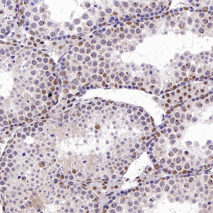 KDM4A Recombinant Rabbit mAb (S-957-138)