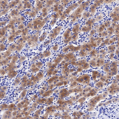 CTEN Recombinant Rabbit mAb (SDT-R175)