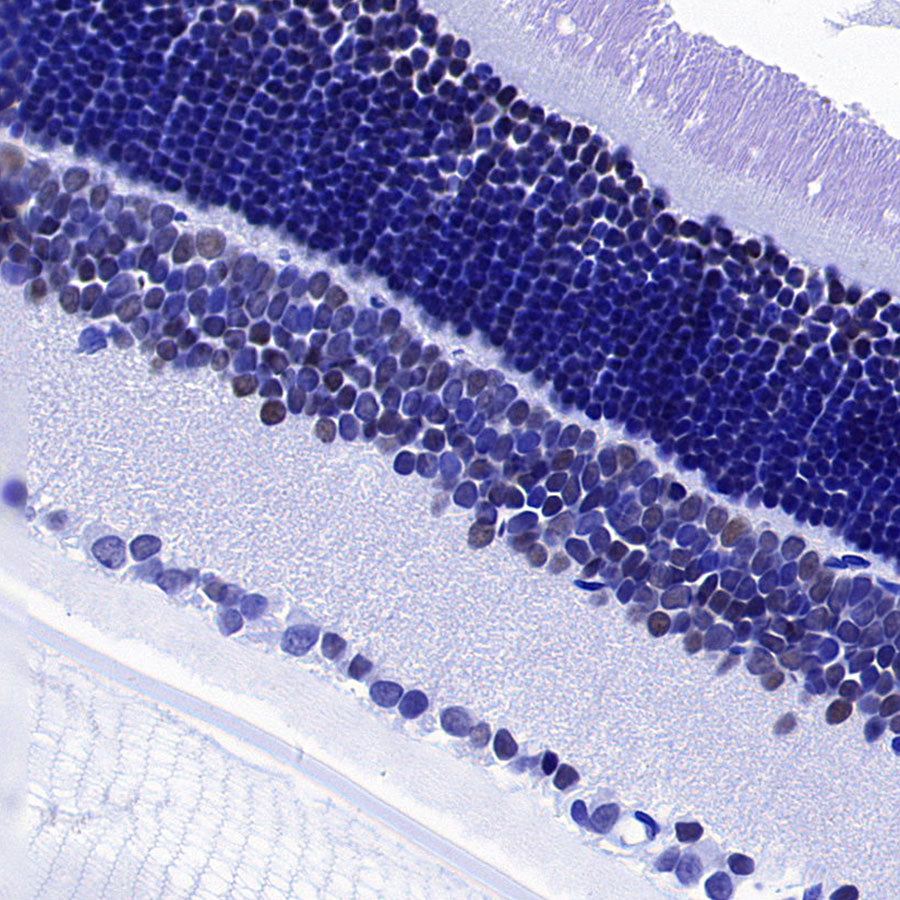 ROR beta/RORB Recombinant Rabbit mAb (S-5483)