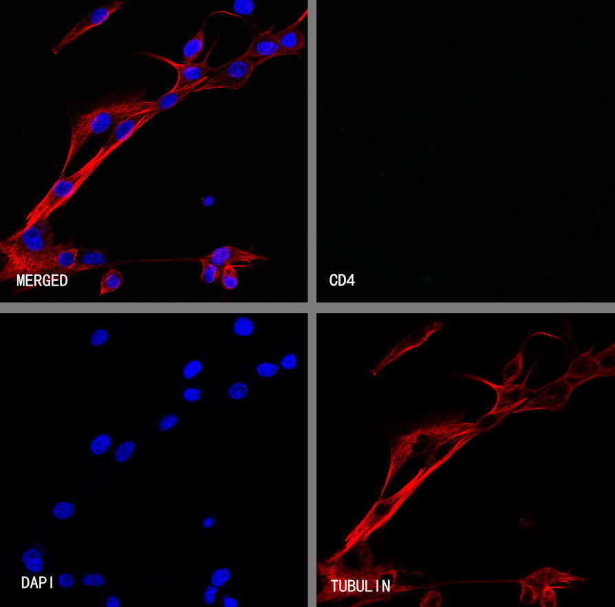 CD4 Recombinant Rabbit mAb (S-6203)