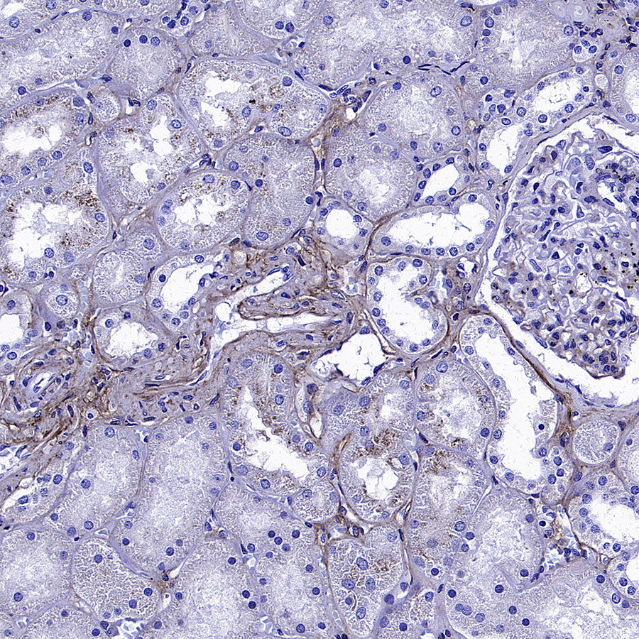 TGFBI / BIGH3 Mouse mAb