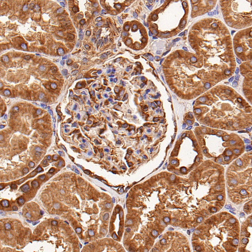 Beta IV Tubulin Rabbit polyclonal antibody