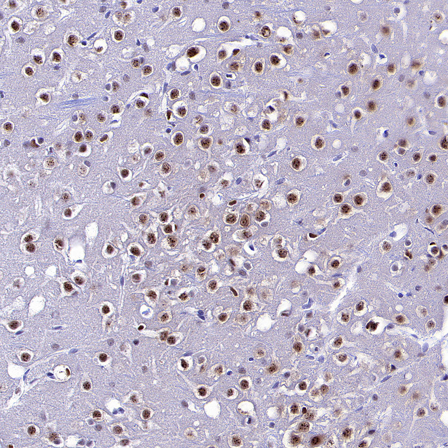 NOVA1 Recombinant Rabbit mAb (S-4031-71)
