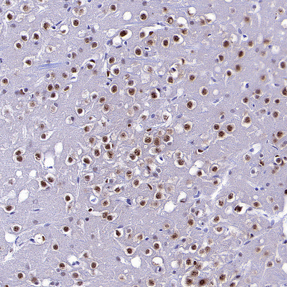 NOVA1 Recombinant Rabbit mAb (S-4031-71)