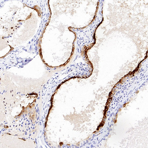 MMP7 Recombinant Rabbit mAb (S-1628-25)
