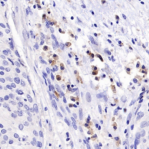 TNFRSF17/BCMA Recombinant Rabbit mAb (S-4674)