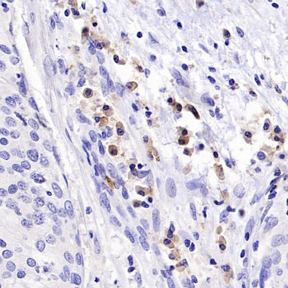 TNFRSF17/BCMA Recombinant Rabbit mAb (S-4674)