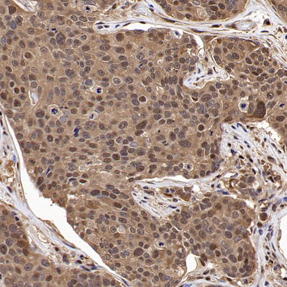 VCP Recombinant Rabbit mAb (S-1818-121)