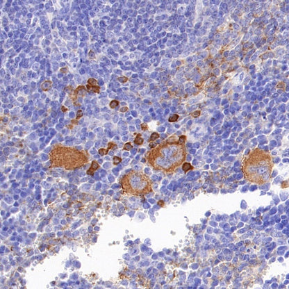 5-HT (Serotonin) Transporter Recombinant Rabbit mAb (S-1332-21)