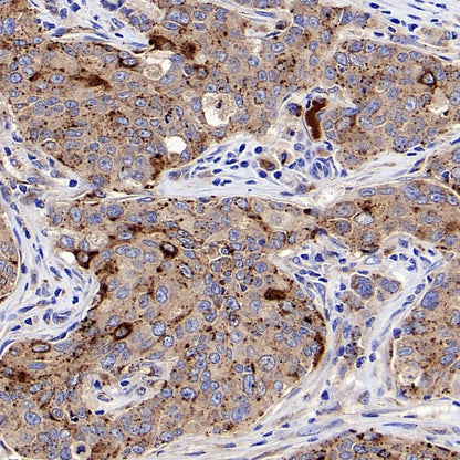 Apo-D Recombinant Rabbit mAb (S-1869-50)
