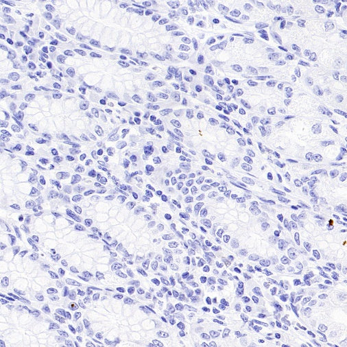 Reg4 Recombinant Rabbit mAb (SDT-1232-23)