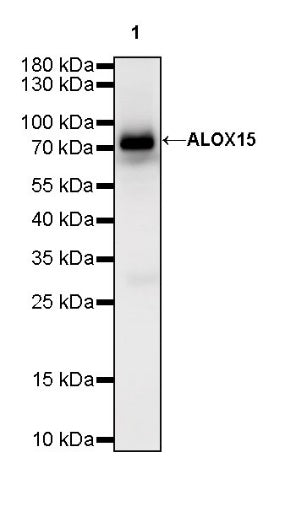 ALOX15 Recombinant Rabbit mAb (S-R308)