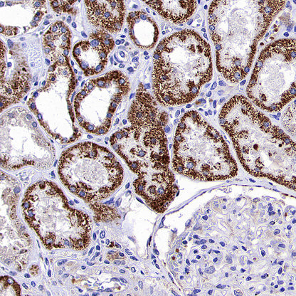 Aldh5a1 Recombinant Rabbit mAb (S-4135-76)