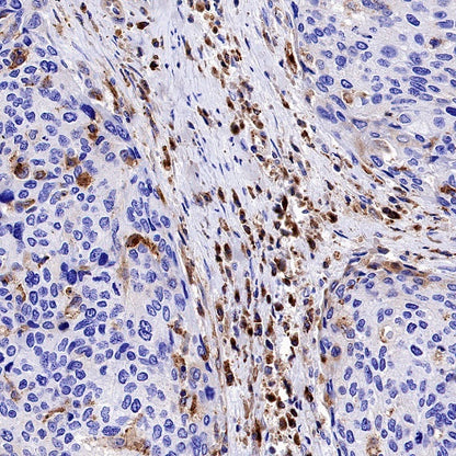 VISTA Recombinant Rabbit mAb (S-1469-72)