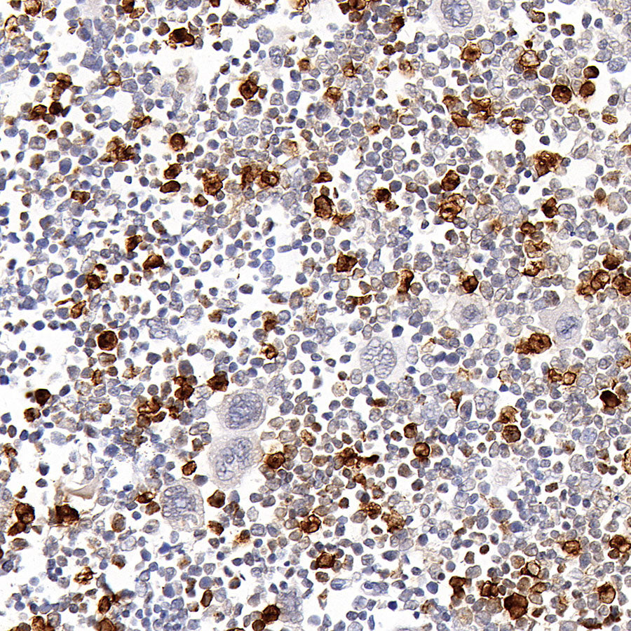 Neutrophil Elastase Recombinant Rabbit mAb (S-4397-22)