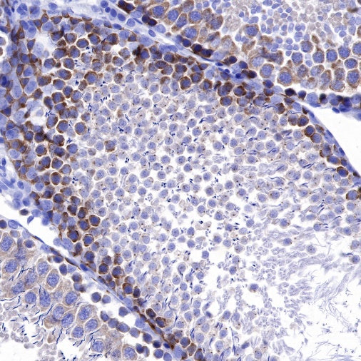 IMP-3 Recombinant Rabbit mAb (S-439-10)