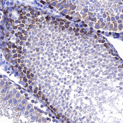 IMP-3 Recombinant Rabbit mAb (S-439-10)