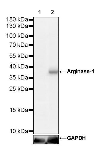 Arginase-1 Recombinant Rabbit mAb (SDT-369-33)