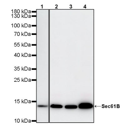 Sec61B Recombinant Rabbit mAb (S-4499-3)