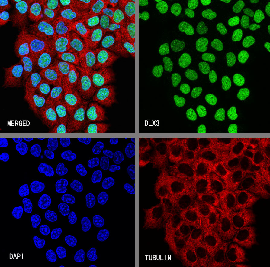 DLX3 Recombinant Rabbit mAb (S-4140-2)