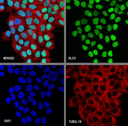 DLX3 Recombinant Rabbit mAb (S-4140-2)
