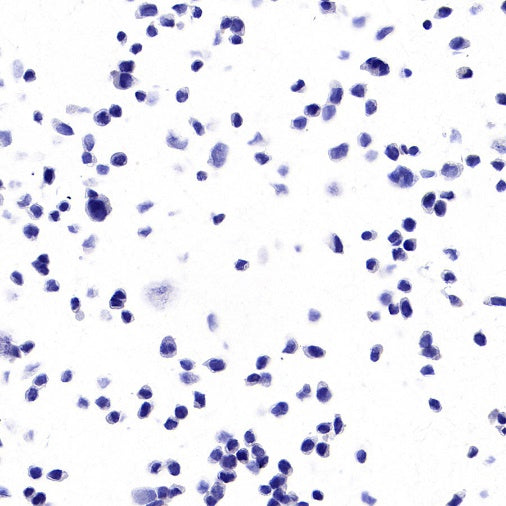 KRAS (mutated GQ60GK) + (mutated Q61K) Recombinant Rabbit mAb (S-604-4)