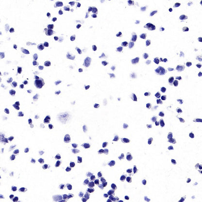 KRAS (mutated GQ60GK) + (mutated Q61K) Recombinant Rabbit mAb (S-604-4)