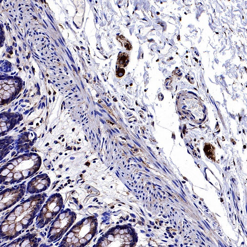Human Cytoplasmic Marker Recombinant Mouse mAb (SDT-2921)
