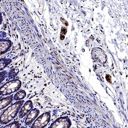 Human Cytoplasmic Marker Recombinant Mouse mAb (SDT-2921)
