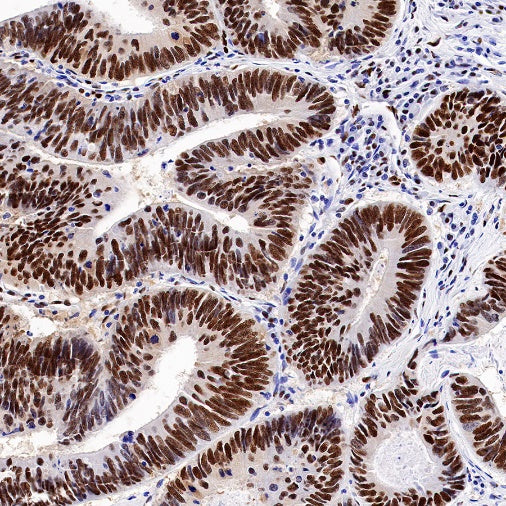 PRMT1 Recombinant Rabbit mAb (S-884-10)