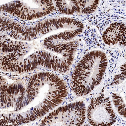 PRMT1 Recombinant Rabbit mAb (S-884-10)