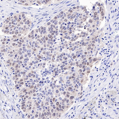 Rad51 Recombinant Rabbit mAb (S-R347)
