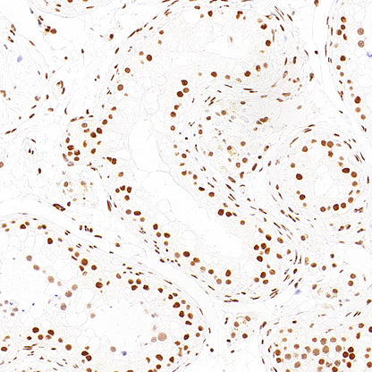 pan Brd4 Recombinant Rabbit mAb (S-6208)