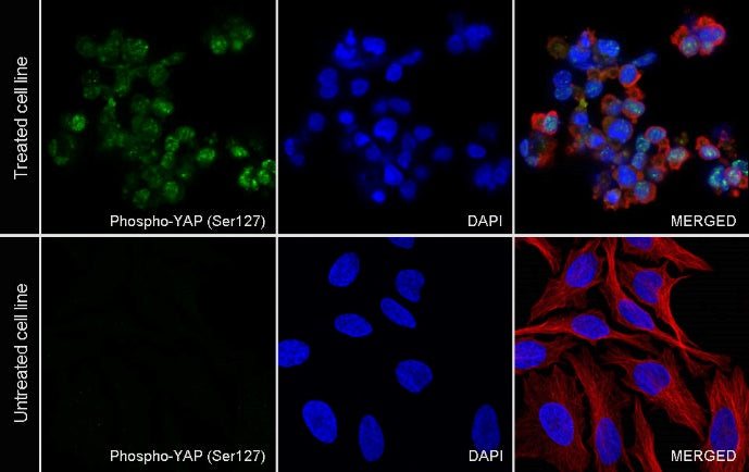 Phospho-YAP (Ser127) Recombinant Rabbit mAb (S-1364-28)