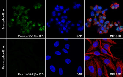 Phospho-YAP (Ser127) Recombinant Rabbit mAb (S-1364-28)