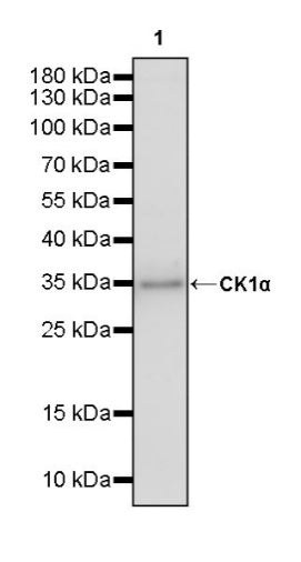 CK1α Recombinant Rabbit mAb (SDT-2884-60)