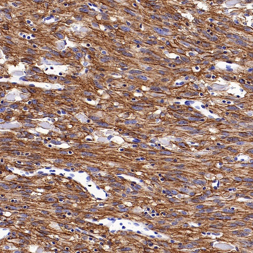 TMEM16A Recombinant Rabbit mAb (SDT-2179-12)