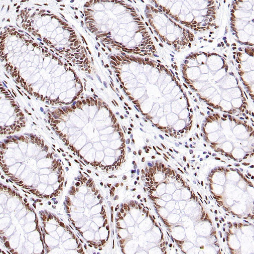 KDM5D Recombinant Rabbit mAb (S-1577-128)