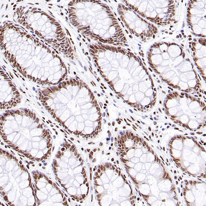 KDM5D Recombinant Rabbit mAb (S-1577-128)