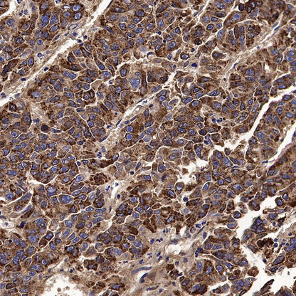 ADK Rabbit Polyclonal Antibody