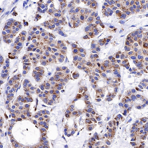 Cathepsin D Recombinant Rabbit mAb (S-R345)