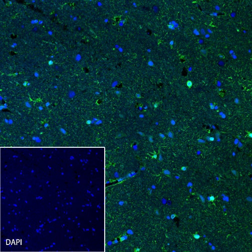 S100B Recombinant Rabbit mAb (Alexa Fluor® 488 Conjugate) (SDT-518-45)