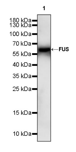 FUS Recombinant Rabbit mAb (S-1015-21)
