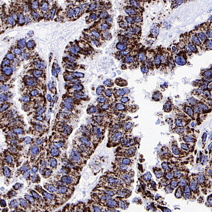 ATPIF1 Recombinant Rabbit mAb (S-3849-49)